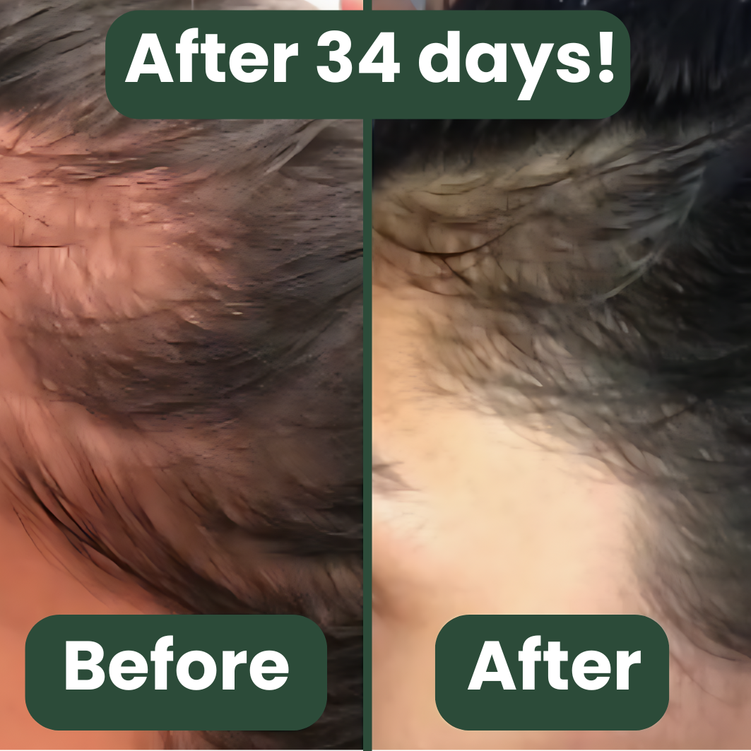 Scalp Serum