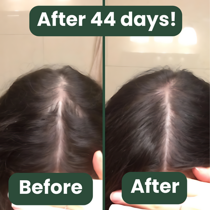 Scalp Serum