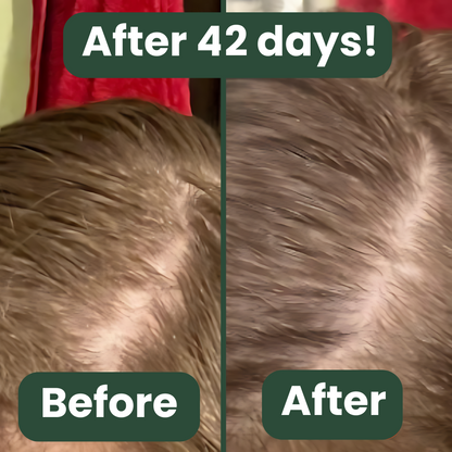 Scalp Serum